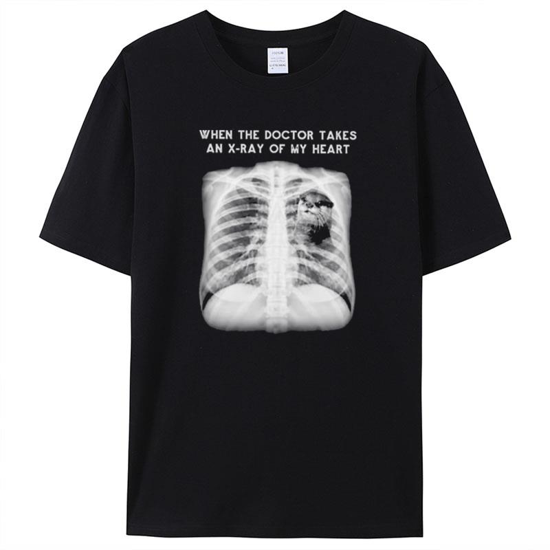 When The Doctor Takes An X Ray Of My Heart Otter Shirts